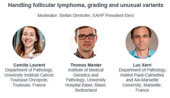 Handling Follicular Lymphoma, grading and unusual variants