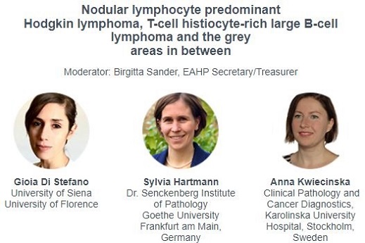Nodular lymphocyte predominant Hodgkin lymphoma, T-cell histiocyte-rich large B-cell lymphoma and the grey areas in between