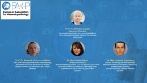 Marginal Zone Lymphoma with a Focus on Nodal and Splenic Types